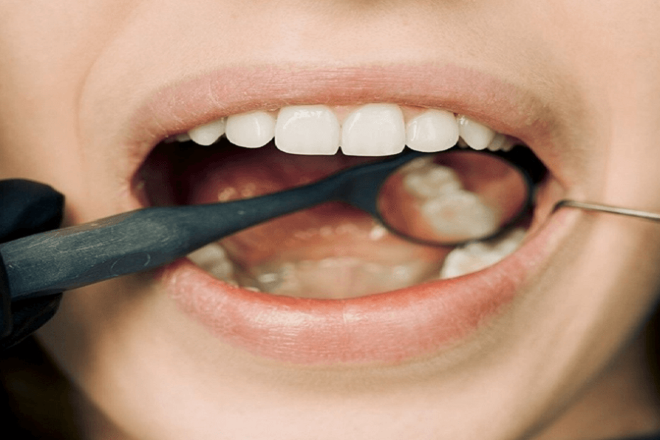 Common Dental Problems And How To Fix Them